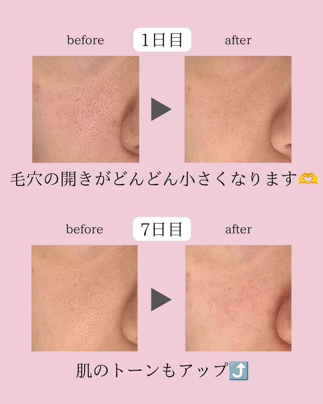 「洗顔してるのに肌がくすんで見える…」